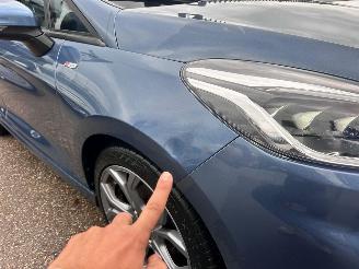 Ford Fiesta 1.0 EcoBoost ST - Line picture 23